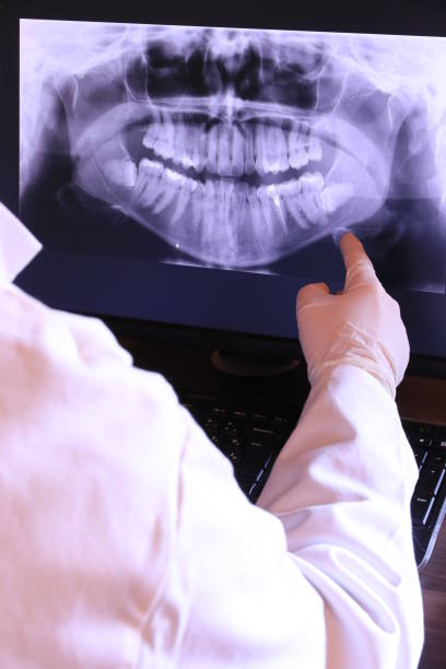 Best Emergency Wisdom Teeth Removal in Ridgeland, MS