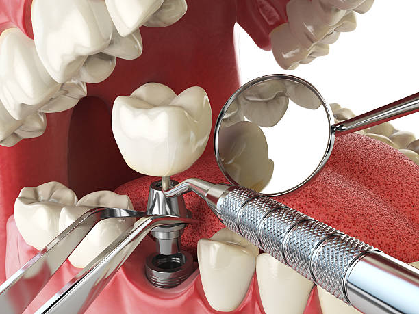 Best Weekend Emergency Dentist in Ridgeland, MS